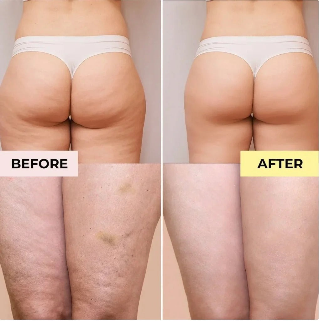Glossay - Anti Cellulite Massage Oil